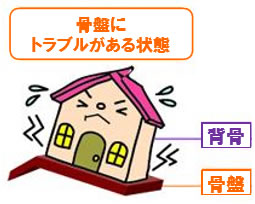 骨盤にトラブルがある状態 骨盤にトラブルがある状態